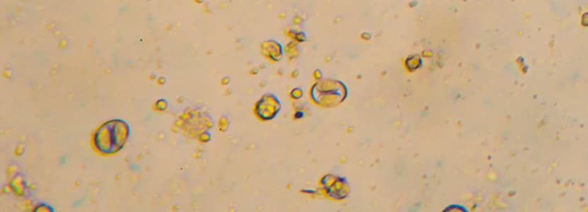 ¿Qué sabemos sobre la coccidiosis en el ganado?