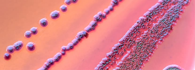 E. Coli resistente a cefalosporinas en el País Vasco