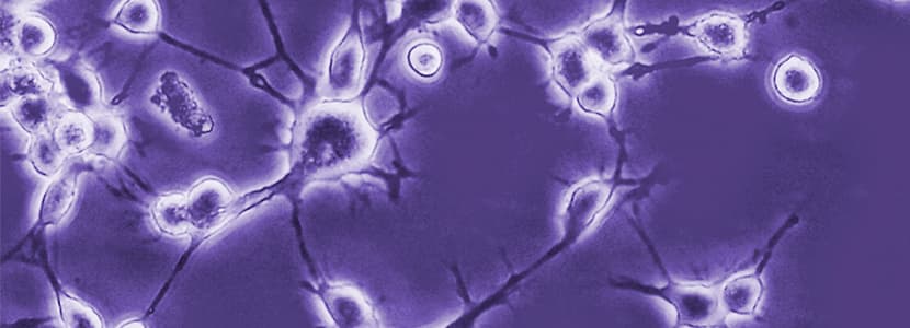 Virus de la encefalitis caprina en corderos
