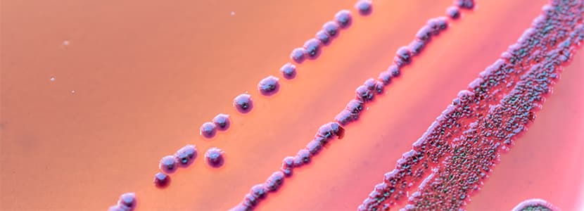 ¿Cómo se adaptan las bacterias a su entorno?