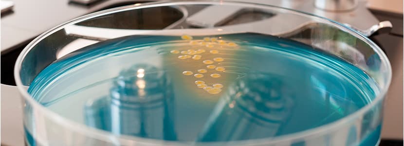 Genes de resistencia contra Campylobacter en muestras de ganado vacuno y ovino