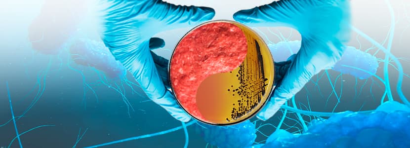 Salmonella y Campylobacter mantienen una alta resistencia antibiótica