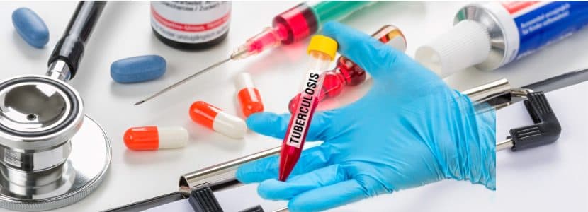 Moratoria en la realización de pruebas de tuberculosis en terneros