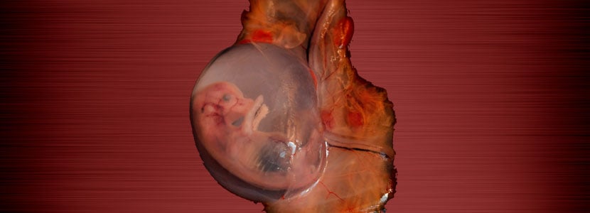 Vacuna contra la neosporosis bovina, principal causa de aborto en vacas