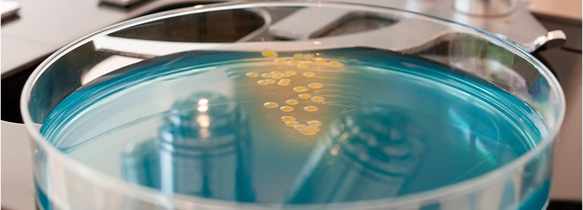 Genes de resistencia contra Campylobacter en muestras de ganado vacuno y ovino