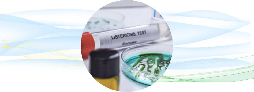 Nuevos hallazgos contra la infección por Listeria