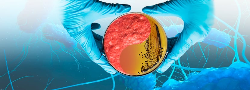 Salmonella y Campylobacter mantienen una alta resistencia antibiótica