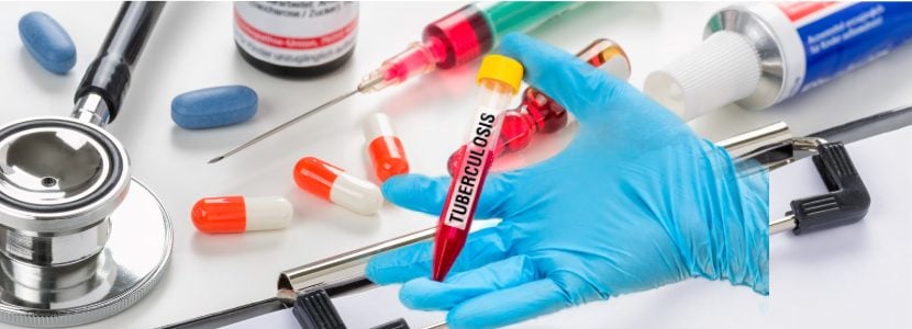 Nuevas medidas de control de la tuberculosis bovina