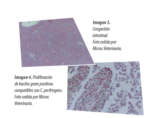 patología sistema digestivo