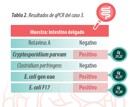 patología digestiva